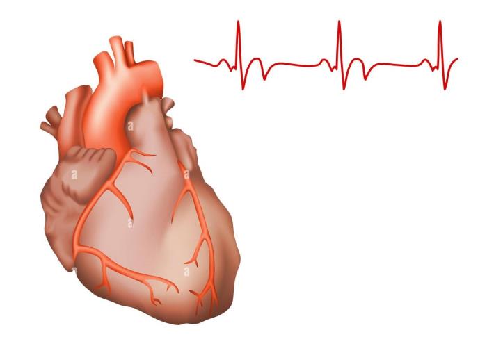 Common Types of Heart Rhythm Disorders