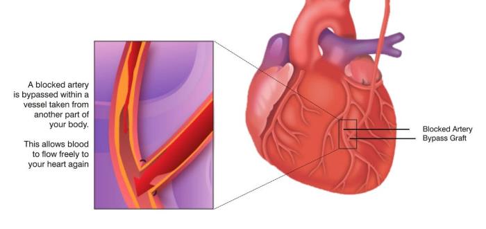 Minimally Invasive Techniques: Benefits and Advances