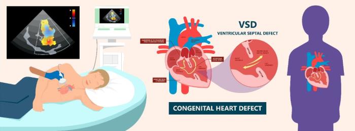 Traditional Imaging Techniques Used to Diagnose VSD