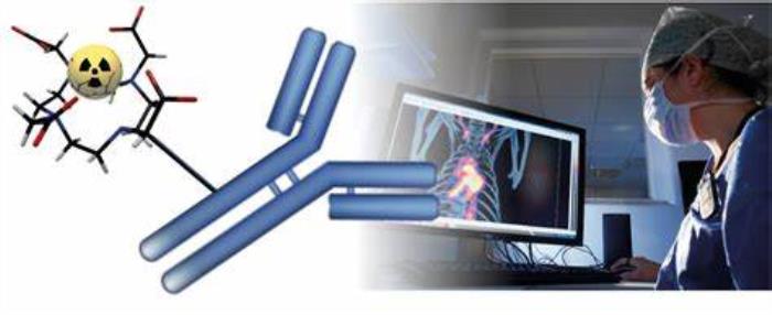 The Role of Contrast Agents in VSD Imaging