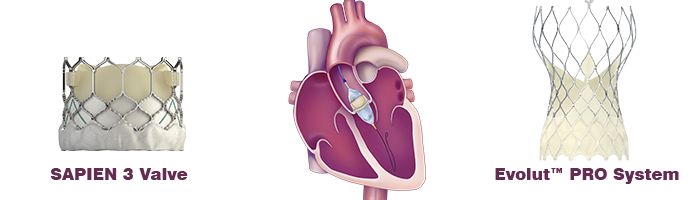 Latest Advancements in TAVR Valve Design