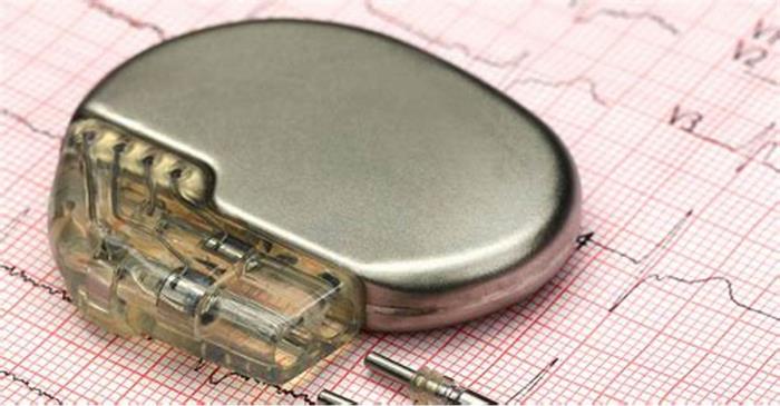 How Long Does a Pacemaker Battery Last