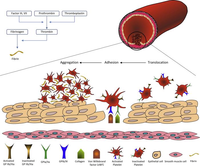 Antiplatelet Therapy