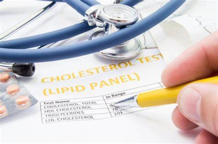 Statins Managing Cholesterol Levels After Mitral Valve Replacement