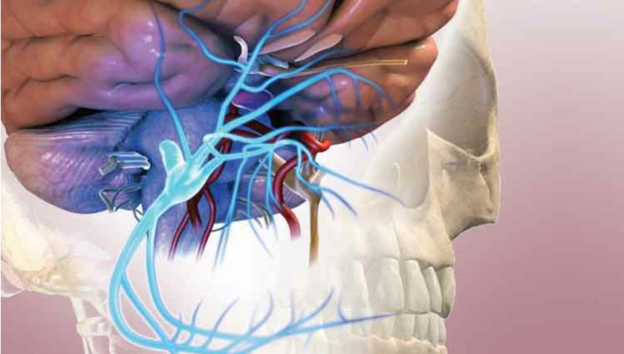  best Trigeminal Neuralgia Surgery in India