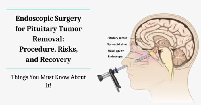 Innovative Techniques for Pituitary Tumor Surgery in India