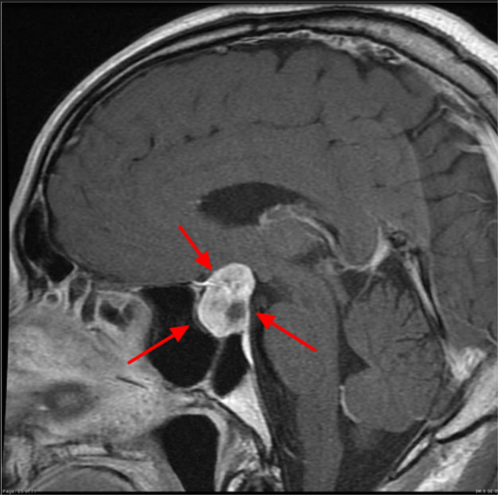 Navigational-Tools-in-Pituitary-Tumor-Surgery