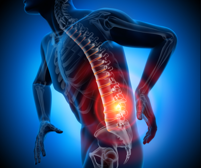 Spinal Injuries: Common Types and Their Anatomical Implications