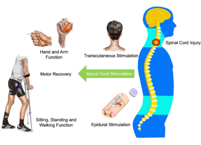 The Importance of Spinal Cord Surgery in India