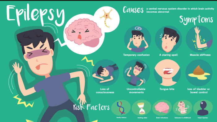 Basics of Epilepsy: Causes and Symptoms