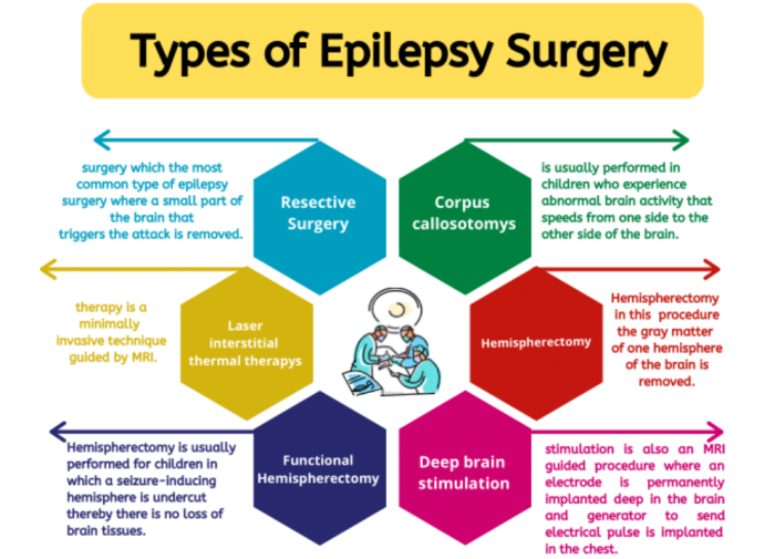 Best surgeries for Epilepsy treatment in India