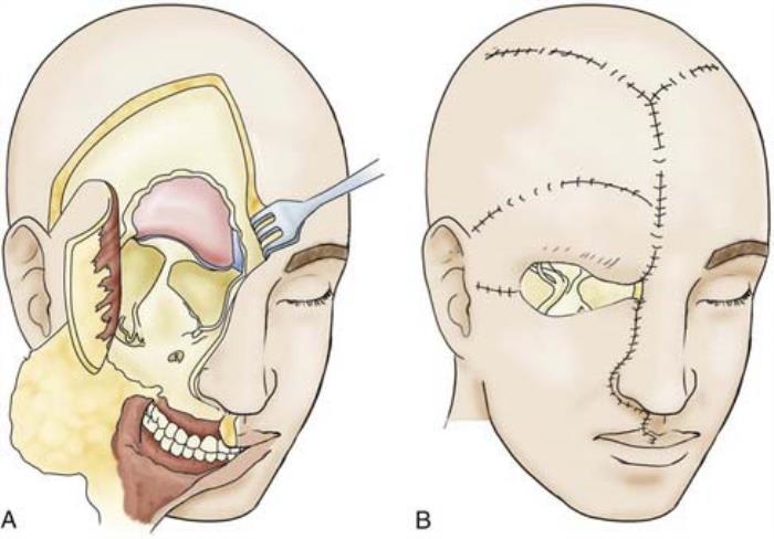 Best hospital for skull base surgery