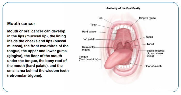 Mouth or Oral Cancer