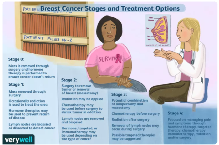 Breast Cancer Treatment Options in India by Stages