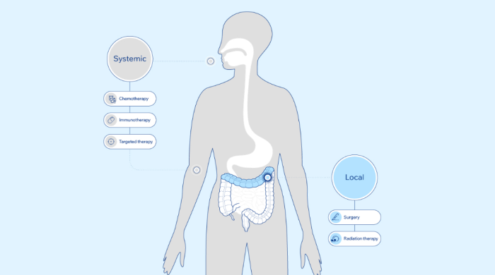 Best Colon Cancer Treatment options in india