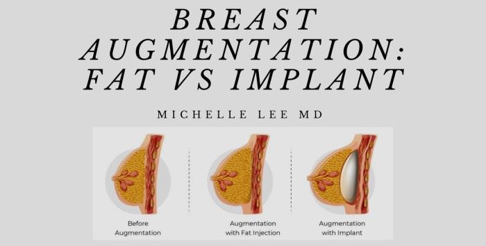 Injectable Fillers for Breast Volume Enhancement