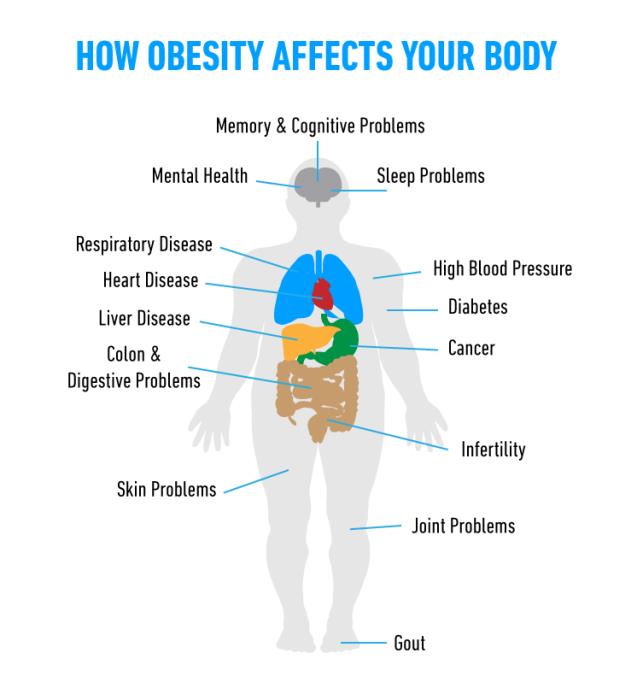 Obesity Affects the Abdomen and Skin