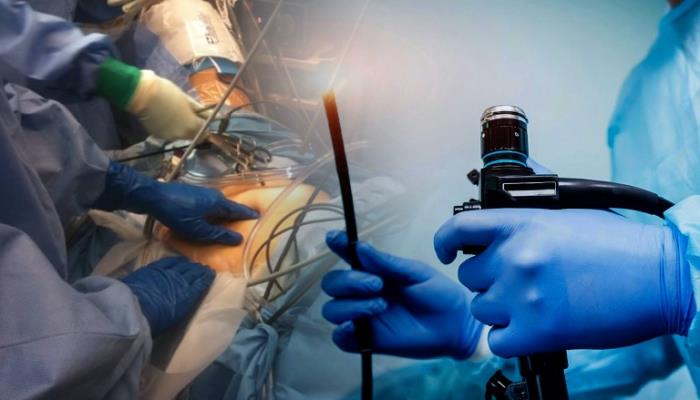 Advances in Endoscopic Devices