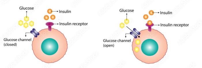 Mini Gastric Bypass and Insulin Sensitivity