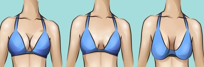 The Impact of Aging on Breast Appearance