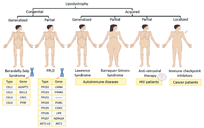 Recognizing Lipodystrophy