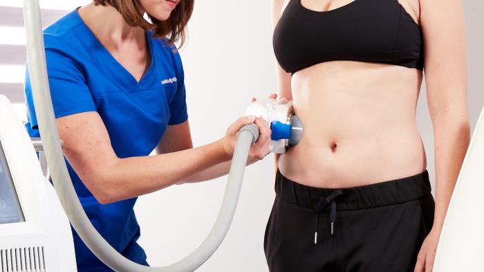 CoolSculpting: The Benefits of Cryolipolysis 