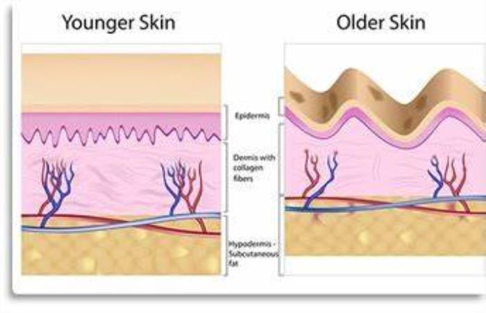 Aging and Genetics Affect Buttock Shape Over Time