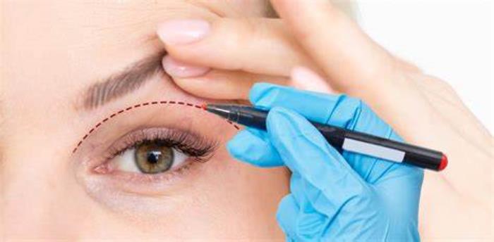 Eyelid Surgery as a Means to Convey Confidence