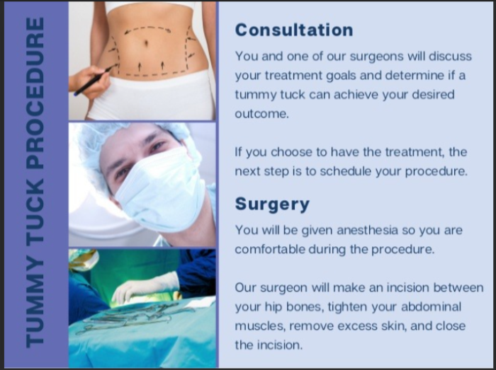 Best Hospital for Tummy Tuck surgeries in India