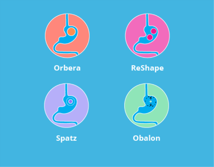 Different Types of Intragastric Balloons