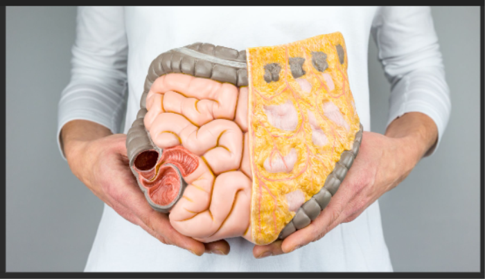 Why Might an Intestine Transplant Be Necessary