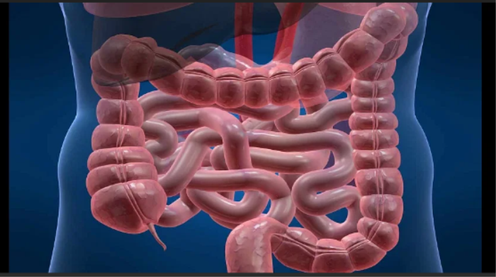 Intestine Transplant Recovery in India