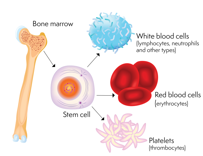 the bone marrow transplant procedure