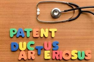 Medications to Relieve Symptoms of Patent Ductus Arteriosus an Overview