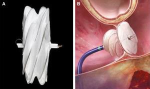 Understanding the Different Types of ASD Closure Devices