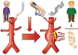 The Impact of Obesity on the Development of Abdominal Aortic Aneurysm