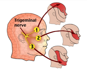 Step-by-Step Guide to Trigeminal Neuralgia Surgery: Complete Process & Recovery