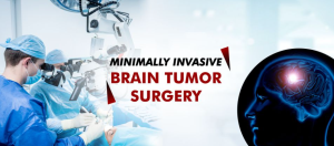 Minimally Invasive Brain Tumor Surgery in India: Benefits and Risks