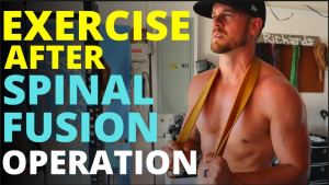 Spinal Fusion Recovery: Timeline, Exercises, and Key Tips for a Successful Healing