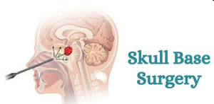 Understanding When Skull Base Surgery is Necessary