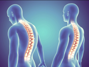 Understanding the Conditions That Spinal Cord Surgery Can Address