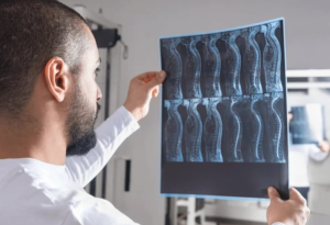 How Imaging Advances Aid in Spinal Cord Diagnoses