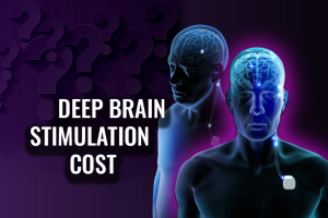 Key Factors That Determine the Cost of Deep Brain Stimulation