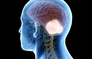 Exploring Non-Surgical Approaches to Chiari Malformation Management