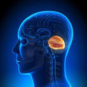 Chiari Malformation Surgery in India