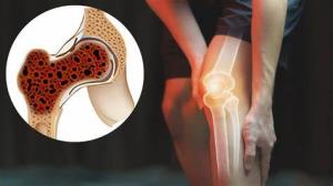 Differences Between Primary and Secondary Bone Cancer