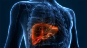 Challenges in Treating Liver Cancer in India