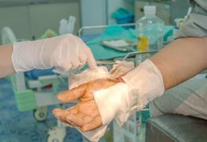 The Importance of Wound Care in Burn Recovery