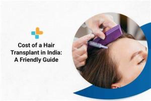 Cost of Hair Transplants in India A Comprehensive Guide