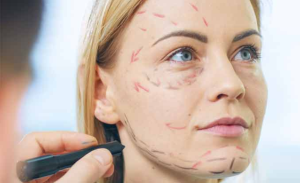 Key Indicators That You May Benefit from Facelift Surgery